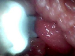 Extreme Proximity Turns Watcher Into Active, Hungry Participant